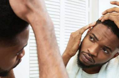 Hair Loss Treatments For Men